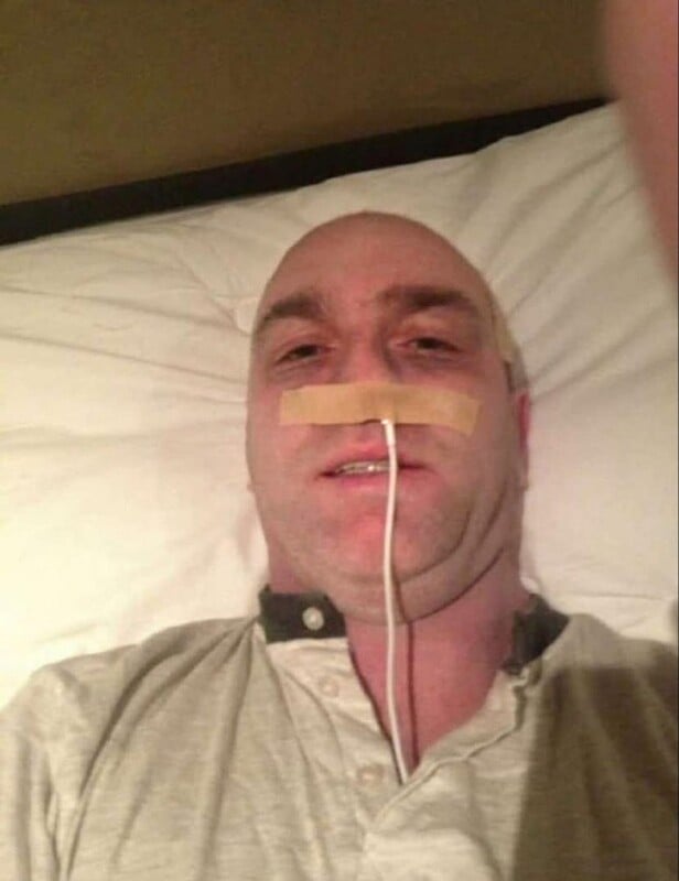 A person lying on a bed with a nasal tube taped to their nose, wearing a gray shirt, looking up at the camera and appearing to take a selfie.