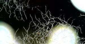 Thin, branching white filaments spread across a dark background, resembling fungal hyphae or root structures, with a few bright, out-of-focus circular spots in the corners.