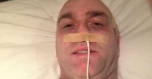 A man lies in bed with a nasal tube secured to his nose by a piece of medical tape. He appears to be looking at the camera while resting on a white pillow.